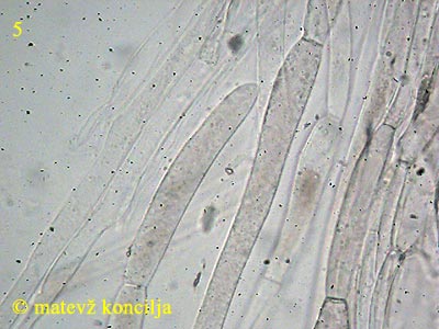 volvariella murinella - epicutis