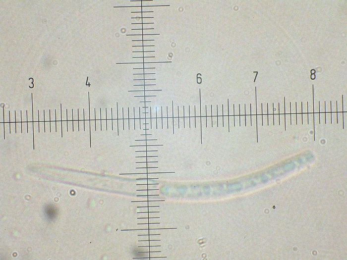 Mycosphaerella podagrariae
