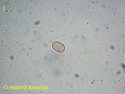 pluteus nanus f. nanus - tros