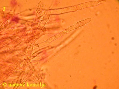 steccherinum ochraceum - skeletocistide