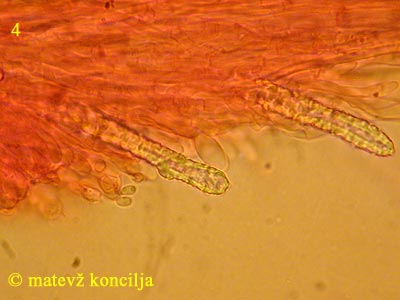 steccherinum ochraceum - skeletocistide