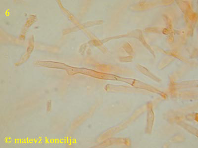 Russula paludosa - Haare