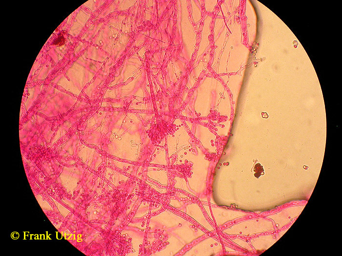 Penicillium olsonii