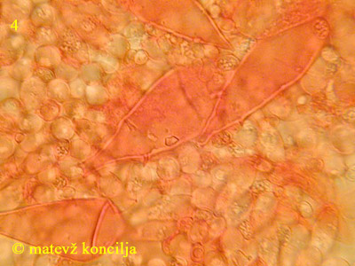 Pluteus petasatus - Pleurozystiden