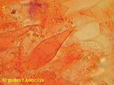 Pluteus petasatus - Pleurozystiden