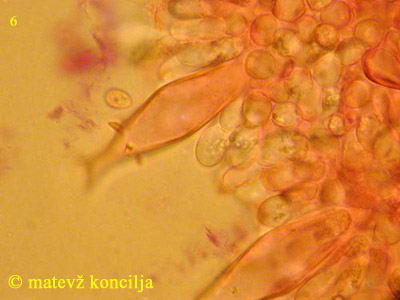 Pluteus petasatus - Pleurozystiden