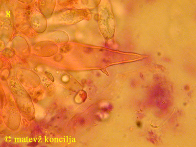 Pluteus petasatus - Pleurozystiden