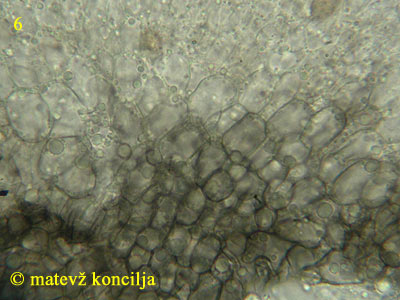 Pyrenopeziza petiolaris - excipulum