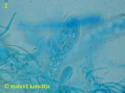 Pezicula livida - Ascus
