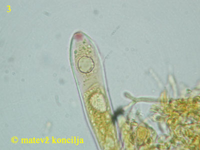 Pezicula livida - Ascus