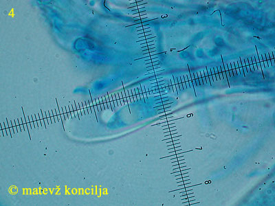 Pezicula livida - Ascospore