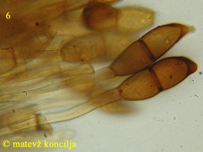 Puccinia magnusiana - Teliosporen