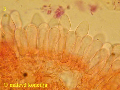 Coprinopsis radiata - Basidien