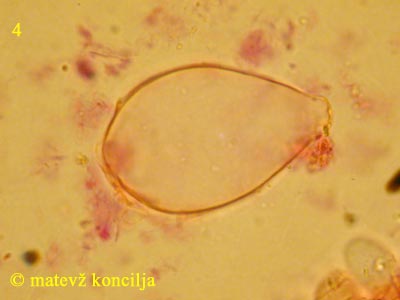 Coprinopsis radiata - Cheilozystide