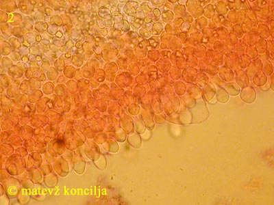 Coprinopsis radiata - Hymenium