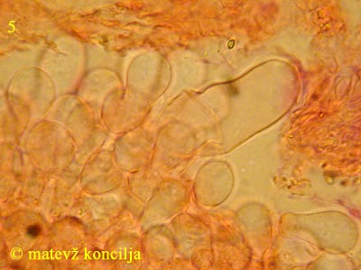 Coprinopsis radiata - cistida