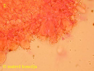 Marasmiellus ramealis - Cheilozystiden