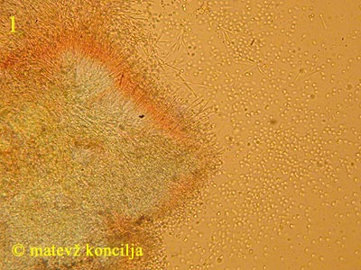 pycnidiella resinae - himenij