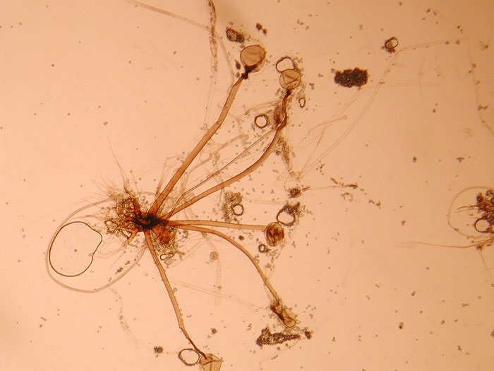 Rhizopus stolonifer