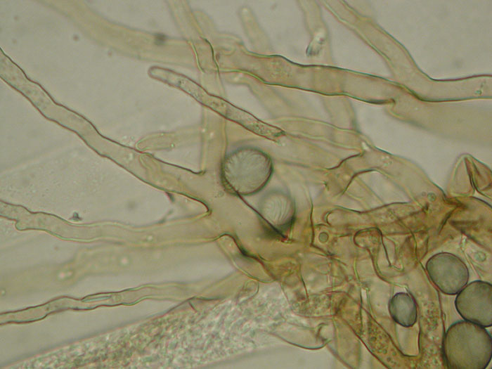 Rhizopus stolonifer
