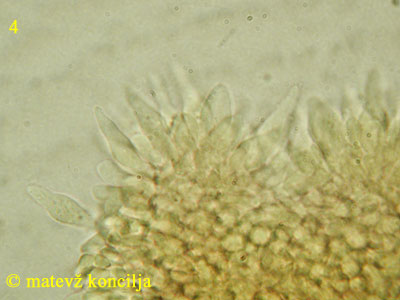 Roridomyces roridus - kajlocistide