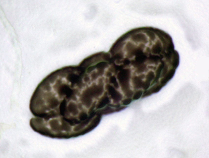 Saccobolus beckii