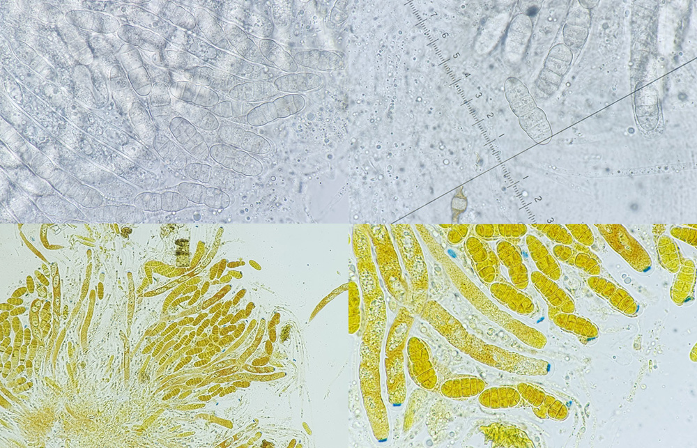 Seimatosporium massarina