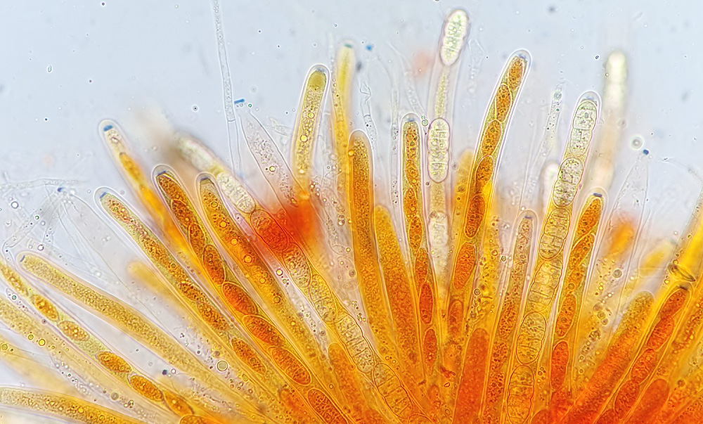 Seimatosporium massarina