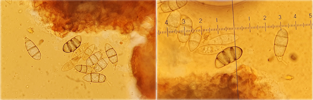 Seimatosporium massarina
