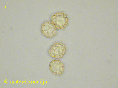 Hemitrichia serpula - Sporen