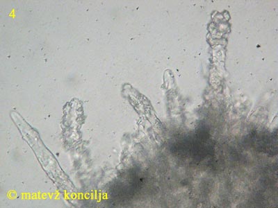 hyphoderma setigerum - septocistide