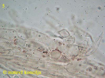 Bonomyces sinopicus - Hutdeckschicht/Pigment