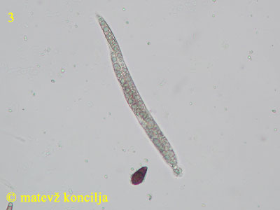 Melogramma spiniferum - Ascus