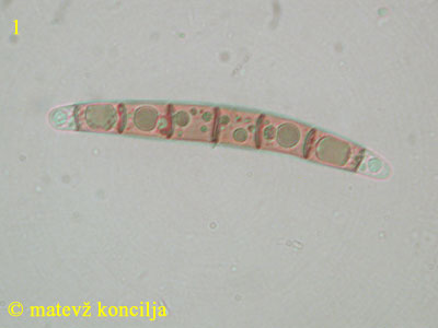 Melogramma spiniferum - Spor
