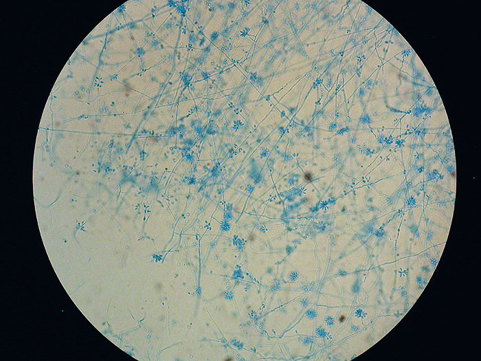 Sporothrix schenckii