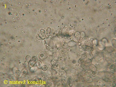 Sphaerobolus stellatus - Basidie