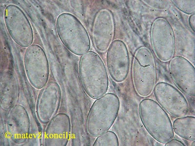 Cheilymenia stercorea - Sporen