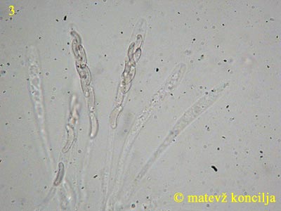 Diatrype stigma - Asci