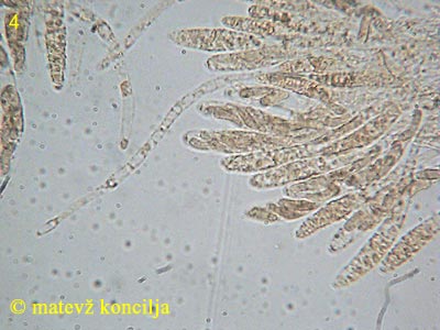 Diatrype stigma - Asci