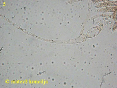 diatrype stigma parafize