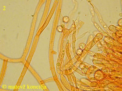 Dacrymyces stillatus - Hymenium