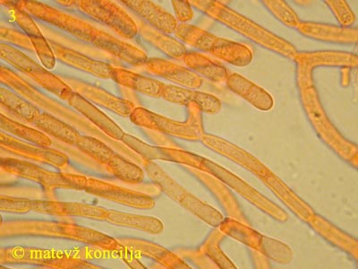 Dacrymyces stillatus - Hyphen