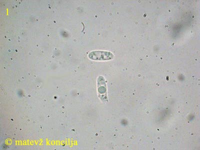 Neofavolus sauvissimus - Sporen