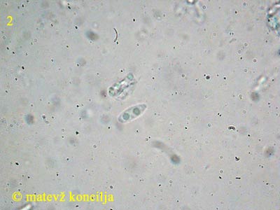 Neofavolus sauvissimus - Sporen