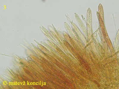 Belonidium sulphureum - aski