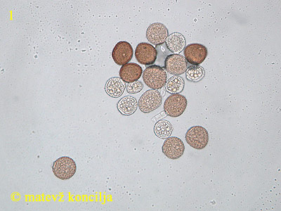 Puccinia taraxaci - Urediniosporen