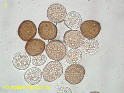 Puccinia taraxaci - Urediniosporen