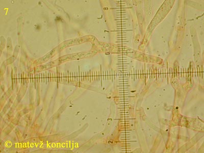 Dacrymyces tortus - Basidie