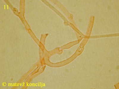 Dacrymyces tortus - Hyphen