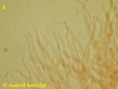 Dacrymyces tortus - Hyphidien